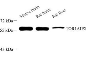 Western blot analysis of TOR1AIP2 (ABIN7075941) at dilution of 1: 500 (TOR1AIP2 Antikörper)