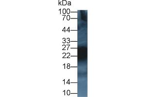 Detection of CD99 in Rat Thymus lysate using Polyclonal Antibody to Cluster Of Differentiation 99 (CD99)