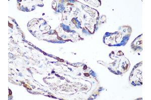 Immunohistochemistry of paraffin-embedded human placenta using MAPK14 antibody (ABIN6291833) at dilution of 1:100 (40x lens).