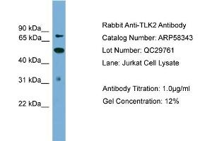 WB Suggested Anti-TLK2  Antibody Titration: 0.