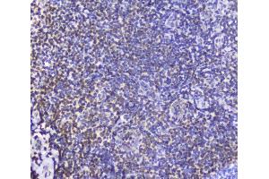 IHC analysis of AHR using anti-AHR antibody (ABIN6719265). (Aryl Hydrocarbon Receptor Antikörper)