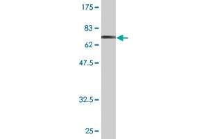 Western Blot detection against Immunogen (78. (CAMK1G Antikörper  (AA 1-476))