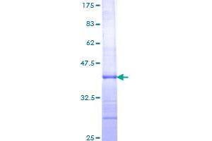 Image no. 1 for Interleukin 12 beta (IL12B) (AA 229-328) protein (GST tag) (ABIN1307678)