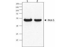 Western Blotting (WB) image for anti-Paired Box 5 (PAX5) antibody (ABIN2667347) (PAX5 Antikörper)