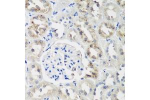 Immunohistochemistry of paraffin-embedded rat kidney using NEDD4L antibody (ABIN6132407, ABIN6144504, ABIN6144505 and ABIN6224109) at dilution of 1:200 (40x lens). (NEDD4-2 Antikörper  (AA 836-955))