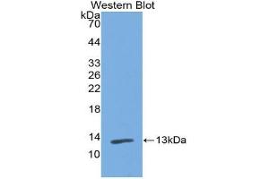 Western blot analysis of the recombinant protein. (PIGR Antikörper  (AA 230-331))