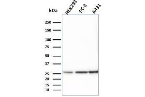 Western Blot Analysis of HEK293, PC-3 and A431 cell lysates using 14-3-3E Mouse Monoclonal Antibody (CPTC-YWHAE-1). (YWHAE Antikörper)