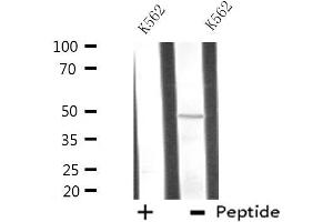 Western blot analysis of extracts from K562 cells using ATG4C antibody. (ATG4C Antikörper  (N-Term))