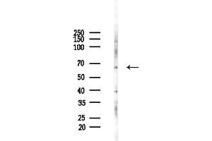 Western blot analysis of lysates from HepG2 cells(LPS,4h treatment), using ATIC Antibody at 1/1000 dilution.