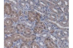 DAB staining on IHC-P; Samples: Rat Kidney Tissue (Regucalcin Antikörper  (AA 1-299))