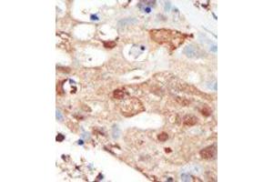 Image no. 2 for anti-Phosphoinositide 3 Kinase, p85 beta (PI3K p85b) (C-Term) antibody (ABIN360460) (PIK3R2 Antikörper  (C-Term))