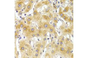 Immunohistochemistry of paraffin-embedded Human liver injury using EIF4G1 antibody at dilution of 1:100 (x400 lens). (EIF4G1 Antikörper)