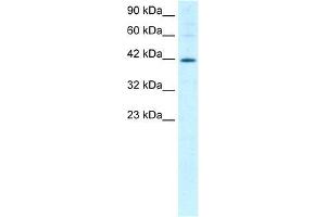 Human Jurkat; WB Suggested Anti-MIER1 Antibody Titration: 1. (MIER1 Antikörper  (Middle Region))
