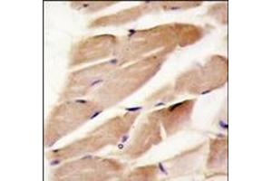 Formalin-fixed and paraffin-embedded human skeletal muscle reacted with PRKAA2 antibody (C-term), which was peroxidase-conjugated to the secondary antibody, followed by DAB staining.