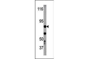 Image no. 1 for anti-Inhibitor of kappa Light Polypeptide Gene Enhancer in B-Cells, Kinase beta (IKBKB) (pTyr199) antibody (ABIN358141) (IKBKB Antikörper  (pTyr199))