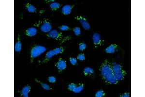 IF analysis of GRASP65/GORASP1 using anti-GRASP65/GORASP1 antibody (ABIN7599953). (GORASP1 Antikörper  (AA 130-440))