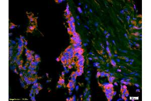 Immunofluorescence (IF) image for anti-Activating Transcription Factor 3 (ATF3) (AA 51-150) antibody (ABIN669561)