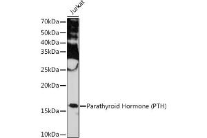 Western blot analysis of extracts of Jurkat cells, using Parathyroid Hormone (PTH) (PTH) Rabbit mAb (ABIN7269175) at 1:1000 dilution. (PTH Antikörper)