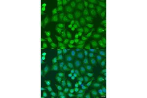 Immunofluorescence analysis of U2OS cells using ZFYVE16 antibody (ABIN2737838) at dilution of 1:100. (ZFYVE16 Antikörper)