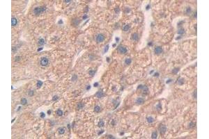 Immunohistochemistry (IHC) image for anti-Matrix Metallopeptidase 24 (Membrane-inserted) (MMP24) (AA 429-642) antibody (ABIN7441787)