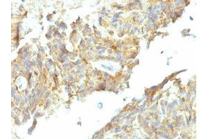 Image no. 2 for anti-Alkaline Phosphatase (ALP) antibody (ABIN6155884) (Alkaline Phosphatase Antikörper)