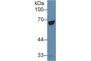 Detection of PCK1 in Human Liver lysate using Polyclonal Antibody to Phosphoenolpyruvate Carboxykinase 1, Soluble (PCK1) (PCK1 Antikörper  (AA 311-558))