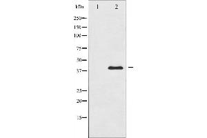 Western blot analysis of MKK3 expression in MDA-MB-435 whole cell lysates,The lane on the left is treated with the antigen-specific peptide.