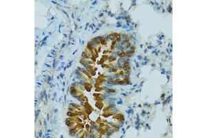 Immunohistochemistry of paraffin-embedded mouse lung using CYP2B6 antibody. (CYP2B6 Antikörper)