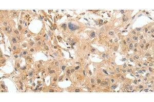 Immunohistochemistry (Paraffin-embedded Sections) (IHC (p)) image for anti-Collagen, Type IV, alpha 1 (COL4A1) antibody (ABIN7237920)