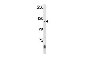 Western blot analysis of K1 Antibody (N-term) (ABIN652404 and ABIN2841978) in Ramos cell line lysates (35 μg/lane). (AAK1 Antikörper  (N-Term))