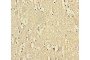 Immunohistochemistry of paraffin-embedded human brain tissue using ABIN7175313 at dilution of 1:100 (VPS33B Antikörper  (AA 348-617))