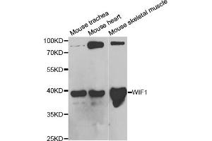 Western blot analysis of extracts of various cell lines, using WIF1 antibody (ABIN5973119) at 1/1000 dilution. (WIF1 Antikörper)