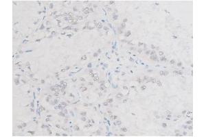 Immunohistochemistry (IHC) image for anti-LIM Domain Kinase 1 (LIMK1) (pThr508) antibody (ABIN6255701)