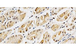 Immunohistochemistry of paraffin-embedded Human stomach using LGALS3 Polyclonal Antibody at dilution of 1:200 (40x lens). (Galectin 3 Antikörper)