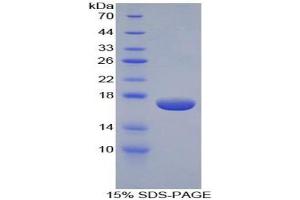 SDS-PAGE analysis of Human Epsin 1 Protein.