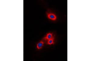 Immunofluorescent analysis of VAV2 staining in THP1 cells. (VAV2 Antikörper  (N-Term))