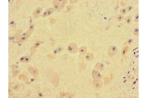 Immunohistochemistry (IHC) image for anti-Transforming Growth Factor, beta Receptor II (70/80kDa) (TGFBR2) (AA 25-159) antibody (ABIN7171961)