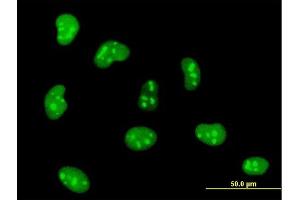 Immunofluorescence of monoclonal antibody to HMGB1 on HeLa cell. (HMGB1 Antikörper  (AA 1-215))