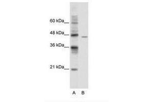 Image no. 1 for anti-DEAD (Asp-Glu-Ala-Asp) Box Polypeptide 25 (DDX25) (AA 355-404) antibody (ABIN6736105) (DDX25 Antikörper  (AA 355-404))
