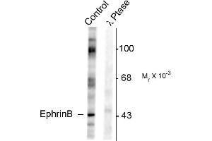 Western blots of rat testes lysate showing specific immunolabeling of the ~46k EphrinB phosphorylated at Tyr317 (Control). (EPH Receptor B2 Antikörper  (pTyr317))