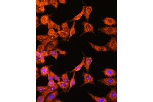 Immunofluorescence analysis of HeLa cells using N-WASP/WASL Polyclonal Antibody (ABIN3016273, ABIN3016274, ABIN3016275, ABIN1683282 and ABIN6219682) at dilution of 1:100 (40x lens).