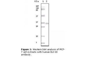 Image no. 2 for anti-B-Cell CLL/lymphoma 10 (BCL10) antibody (ABIN207592) (BCL10 Antikörper)