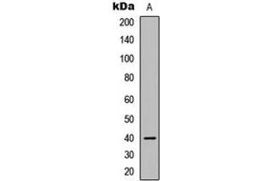 Western Blotting (WB) image for anti-Calcium Channel, Voltage-Dependent, gamma Subunit 7 (CACNG7) (C-Term) antibody (ABIN7301528)