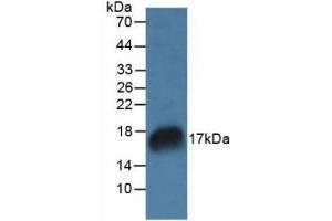 Detection of RNASE7 in Rat Marrow Tissue using Polyclonal Antibody to Ribonuclease A7 (RNASE7) (RNASE7 Antikörper  (AA 31-155))