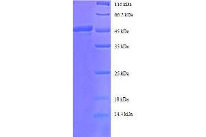 ADP-Ribosylation Factor 4 (ARF4) (AA 1-180), (full length) protein (GST tag) (ARF4 Protein (AA 1-180, full length) (GST tag))