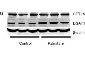 miR-30c-5p expression and triglyceride accumulation in db/db mice(A) Relative expression of miR-30c-5p among different organs. (beta Actin Antikörper)