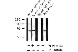 Western blot analysis of Phospho-NF kappaB p65 (Ser281) expression in various lysates (NF-kB p65 Antikörper  (pSer281))