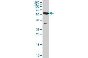 PKM2 monoclonal antibody (M01A), clone 5D2-3B3 Western Blot analysis of PKM2 expression in HeLa . (PKM2 Antikörper  (AA 1-531))