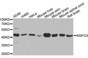 Western blot analysis of extracts of various cell lines, using RSPO3 antibody. (R-Spondin 3 Antikörper)