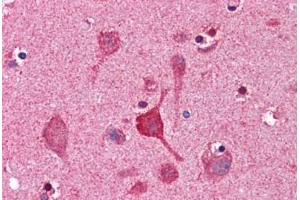 Human Brain, Cortex: Formalin-Fixed, Paraffin-Embedded (FFPE) (CCNDBP1 Antikörper  (AA 348-360))